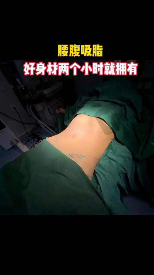 卫兵兵医生擅长的医美项目