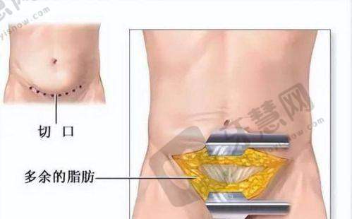 沈阳元辰整形医院正规吗?