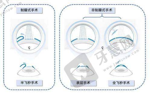 郑州华厦视光眼科医院特色项目及技术优势