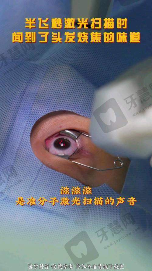 赵利聪医生技术优势