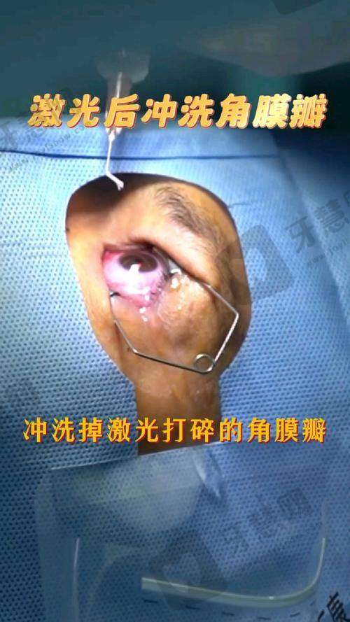 二、昆明眼科医院是否可乘坐地铁3号线直达？