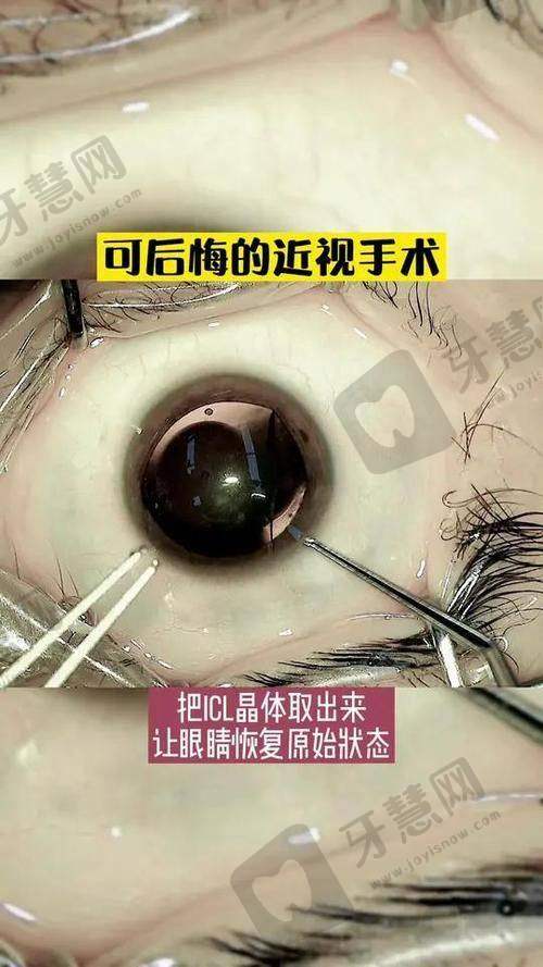 昆明眼科医院的地址在哪？能否乘地铁3号线或公交直达？可约到达,看在线预约便捷通道速览