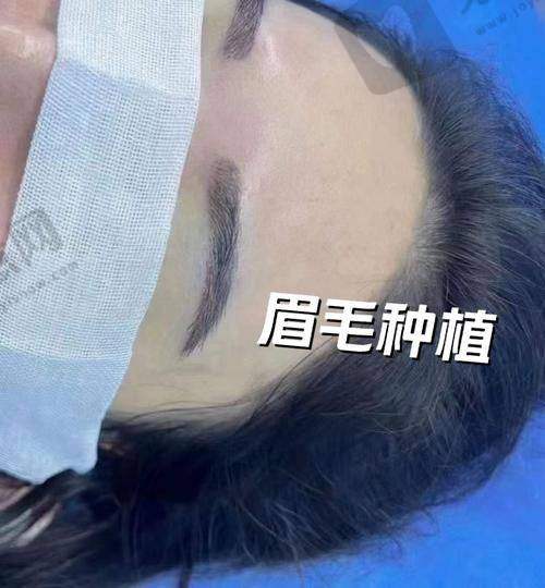 北京大麦植发医疗美容医院价格表