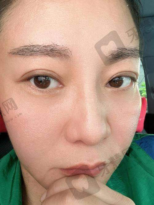 北京纯粹整形医院价格表