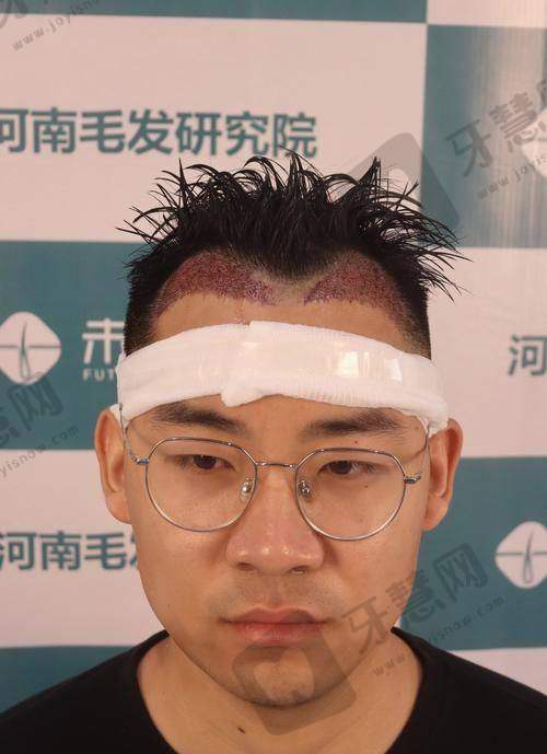 烟台曙光医疗美容医院收费贵吗？