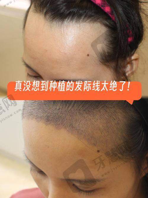 太原欧美莲医疗美容医院预约挂号