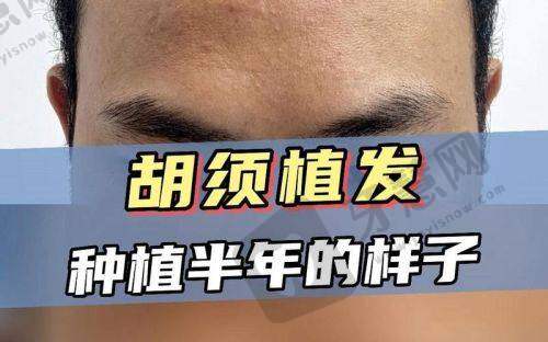 北京叶子医疗美容医院价格表