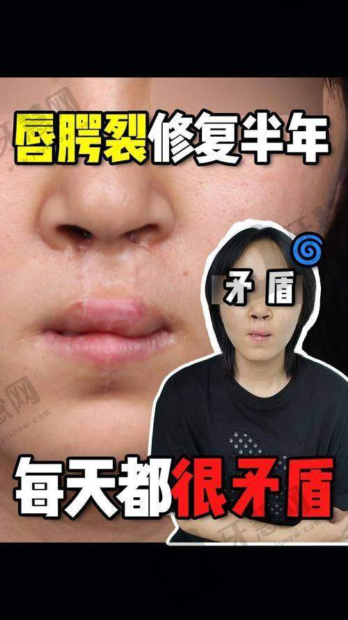 太原华晋医院整形科预约挂号
