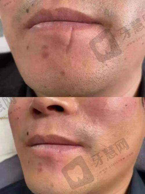 王志涛 鼻综合主刀医生