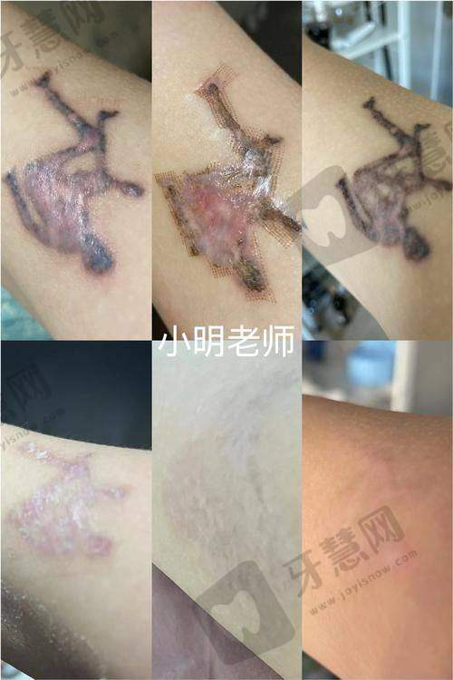 辽宁曙光（原协和）整形医院地址电话