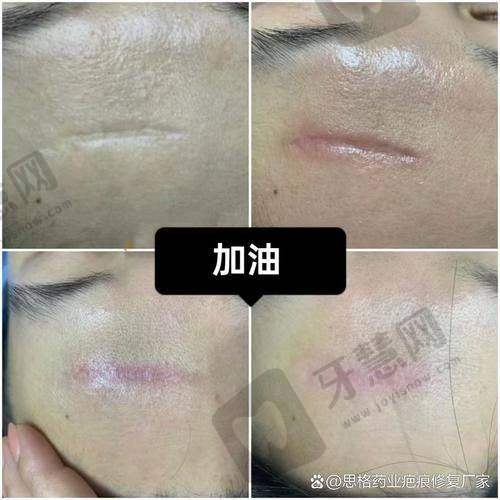 沈阳华美疤痕医院医生介绍