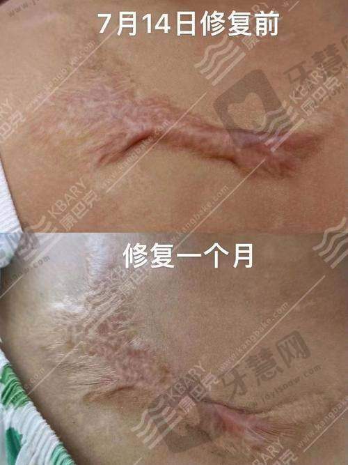 沈阳华美疤痕医院诊疗项目