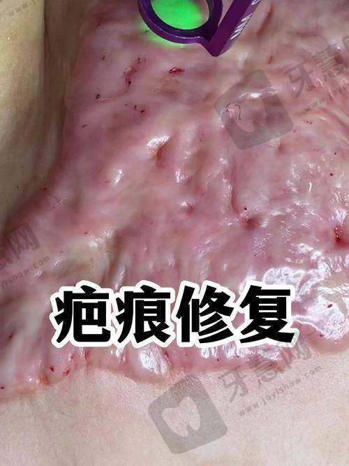 沈阳华美疤痕医院是国有的吗?