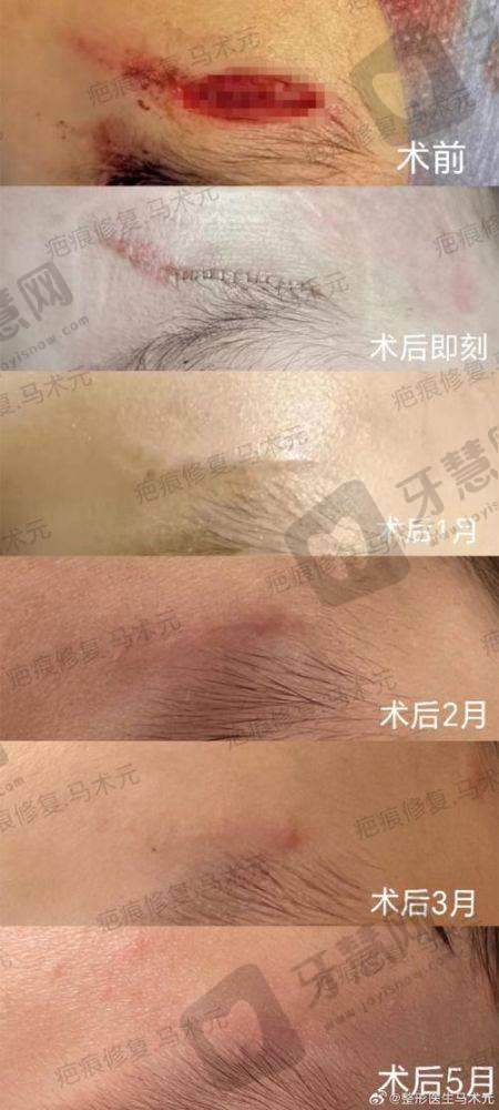 沈阳华美疤痕医院正规吗?
