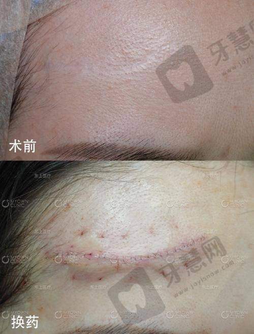 沈阳华美疤痕医院地址电话