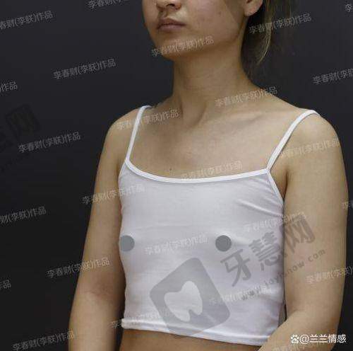王莉医生擅长的医美项目