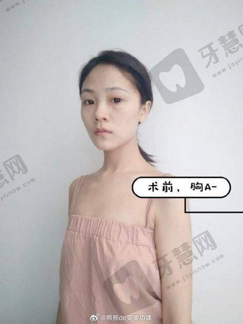 侯亚杰 微创抗衰骨干医生