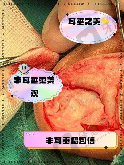 烟台曙光医疗美容医院口碑如何