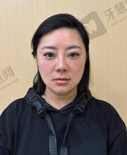 沈阳七悦一美整形医院诊疗项目