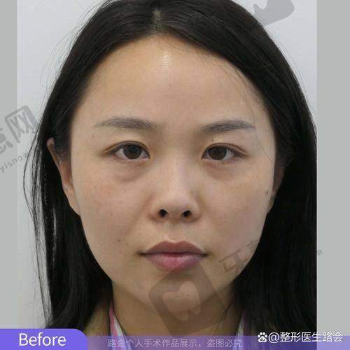 东莞壹加壹整形医院口碑如何