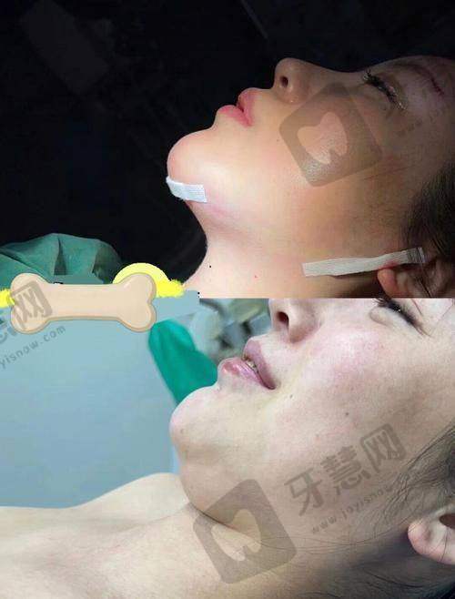 北京嘉禾整形医院价格表