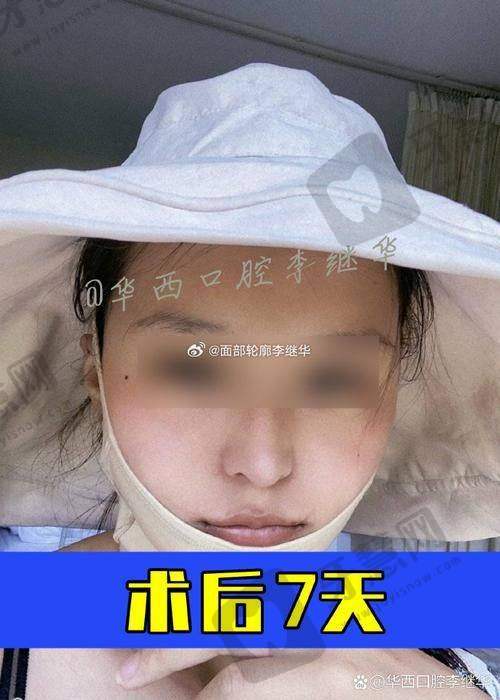 北京张菡丽格医疗美容诊所价格表