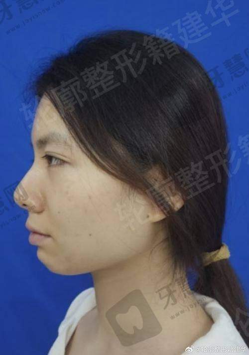 北京纯粹整形医院怎么样，口碑评价如何？