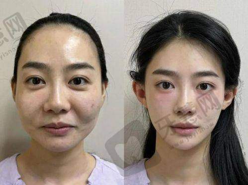 韩昱华医生的执医荣誉与影响力