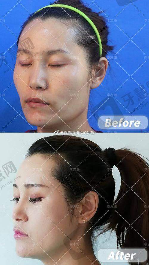何照华医生的坐诊医院详情