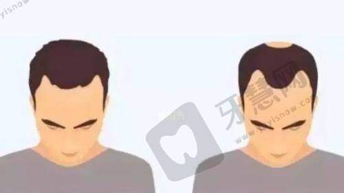 师丽丽医生手术的其他突出特点