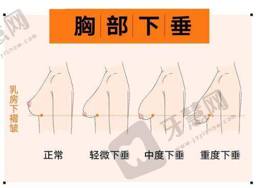 长春中妍整形医院价格：双眼皮3500-9500元、隆鼻8500-29000元