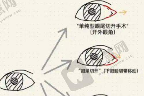 北京丰联丽格整形医院师丽丽院长修复双眼皮价格