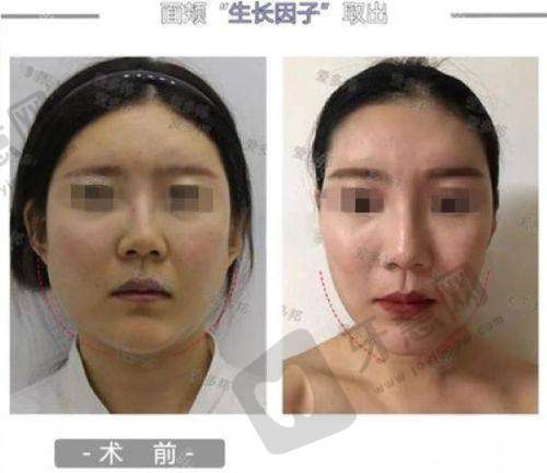 上海今识医疗项目怎么样,擅长光电注射
