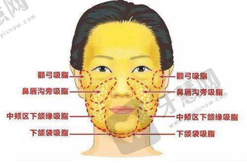 三、解密妈生腰臀比脂肪塑形术:8大核心优势