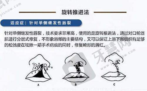 六、预约挂号全攻略：3种方式快速锁定李衍江副主事亲诊