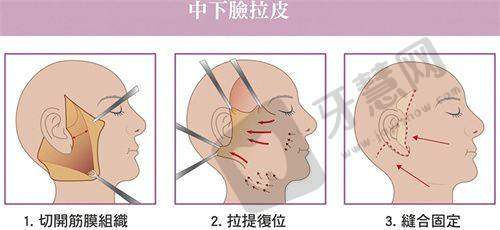 北京丰联丽格师丽丽眼修复患者口碑：赢得患者信赖