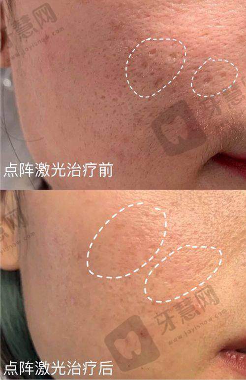 六、辽宁曙光医美车金昊巨乳缩小术预约挂号指南