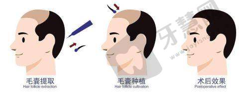 2. 价格优势解析