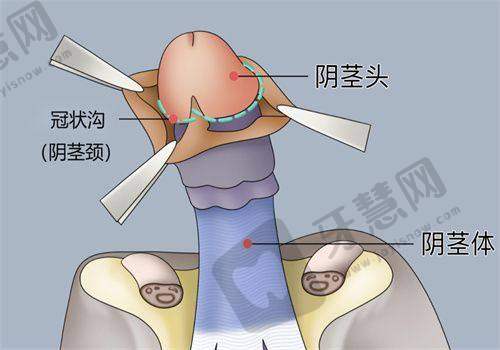 二十四种阴唇形状之白虎型解析