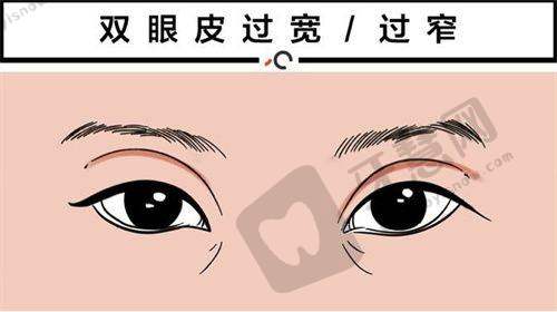 北京丰联丽格师丽丽医生眼修复实例成效展示