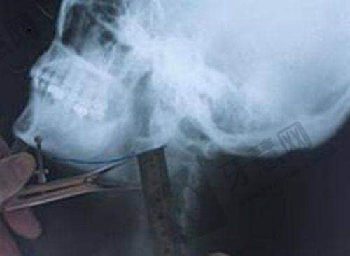 上海今识医美价格是否透明合理
