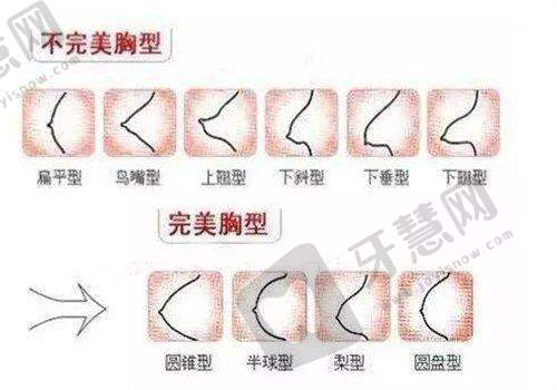 北京丰联丽格师丽丽S - ACC复合体“三层”眼修复技术：创新引领修复潮流