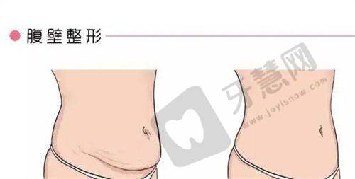 北京美莱整形美容医院口碑好不好?附真实患者口碑评价