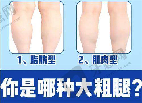 广州海峡整形医院:多维清奥技术领跑