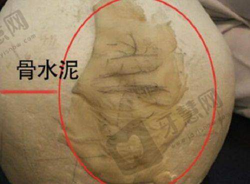 五、沈阳百嘉丽医疗美容医院：东北整形标杆，安心塑美典范