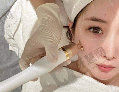 二十四种阴唇形状之海葵型解析