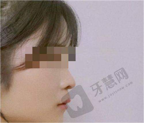 李继森医生口碑评价及反馈内容