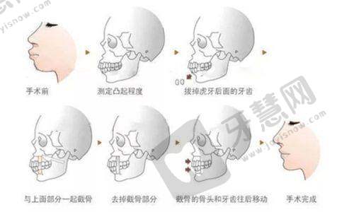 国内乳房奥美定取出指定修复医院名单公布，清奥技术哪家强？