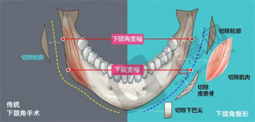 肖明医生技术水平高