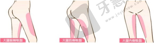 张利民医生的技术优势亮点